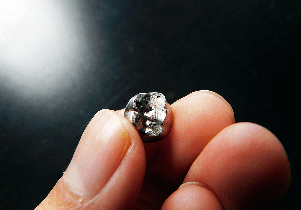 取れてしまった銀歯